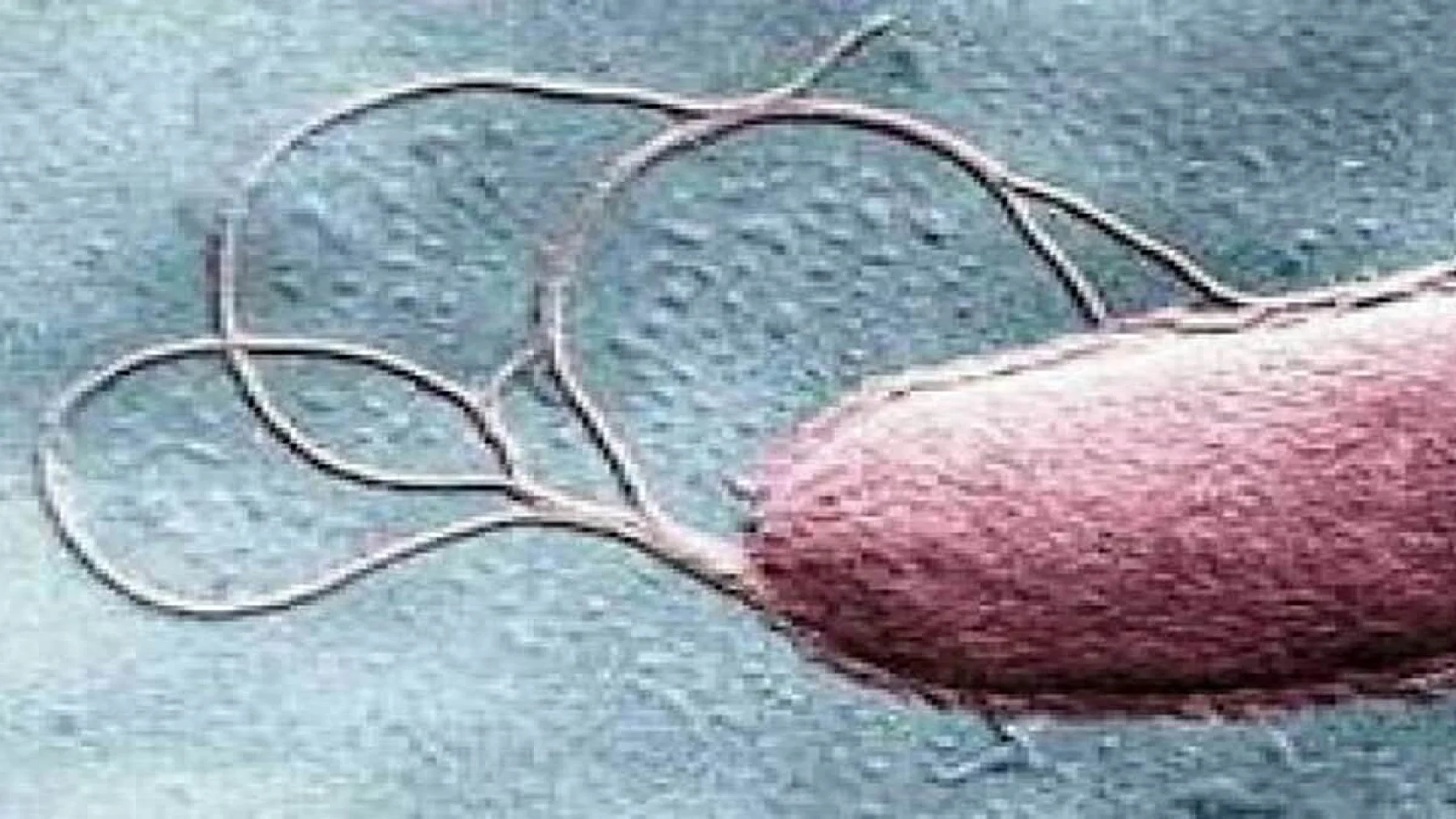 Sabotaging flagella of bacteria to halt infections.
