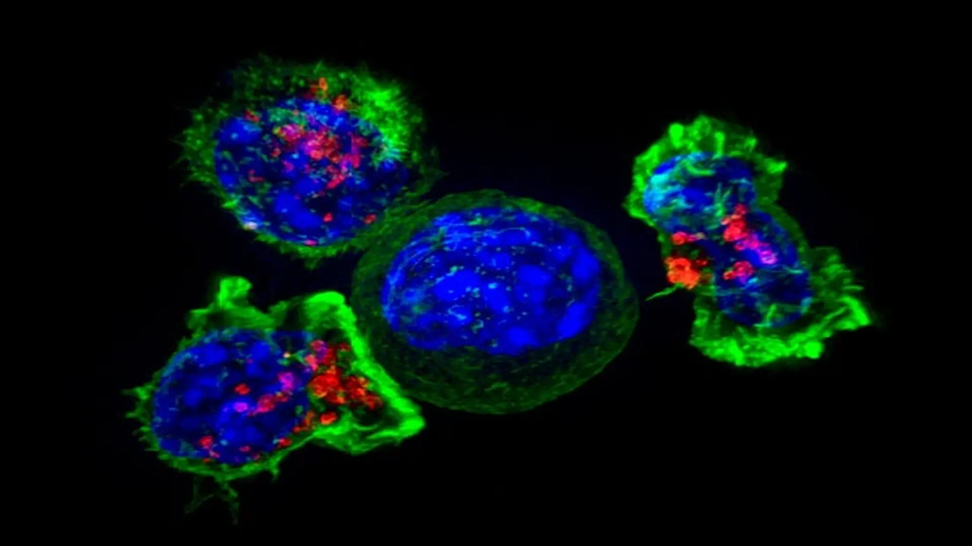 Killer T Cells Surround Cancer Cell Nih