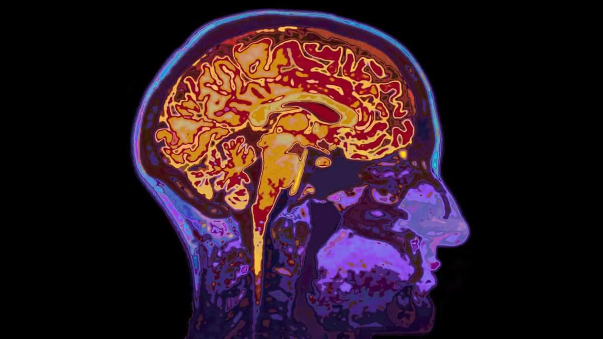 Your Brain May Clean Itself Better At Night And Mit Found A Way To Amplify The Process Scaled