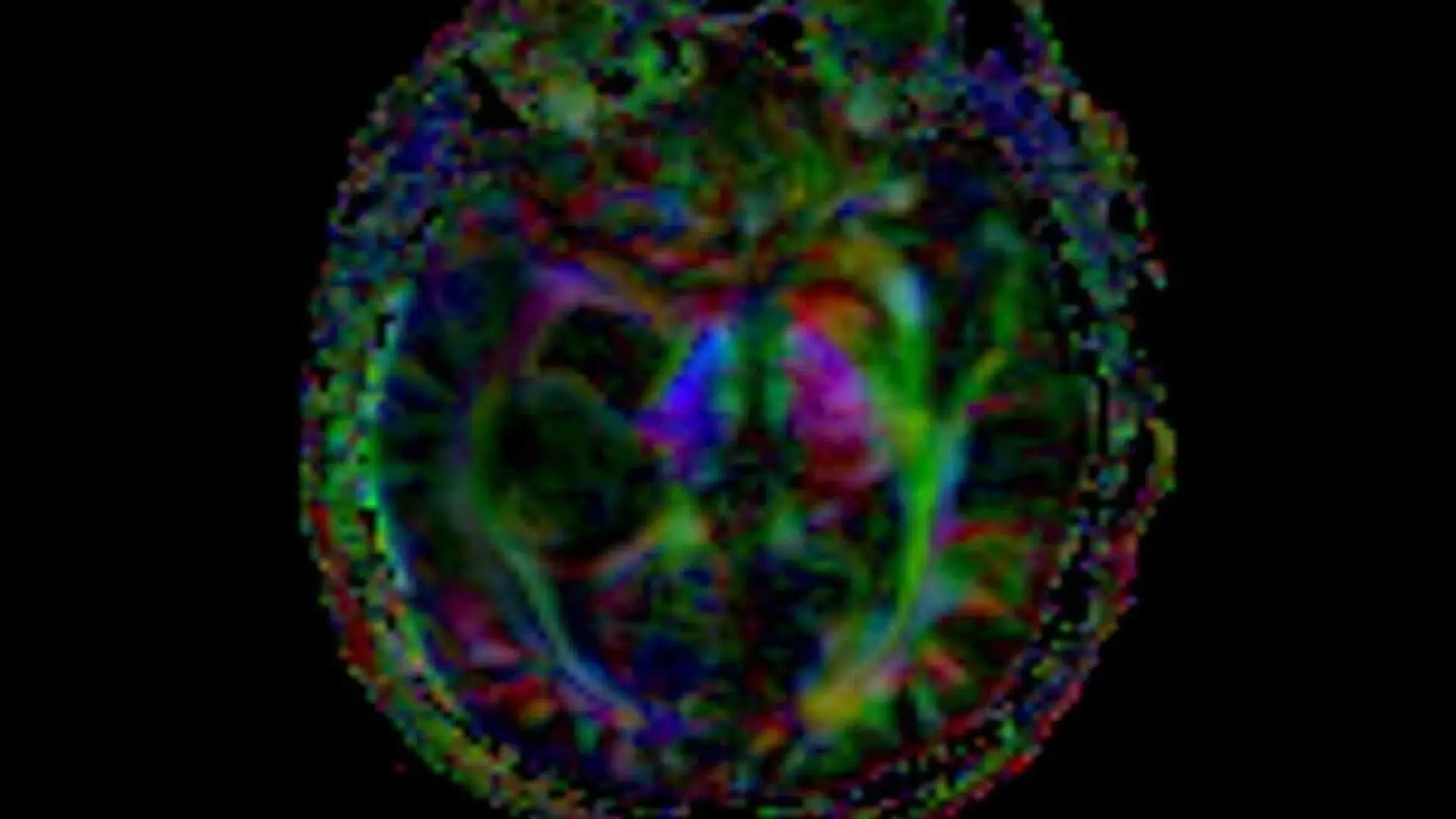 Postprocessed 3d Mri Image Showing Brain Scaled