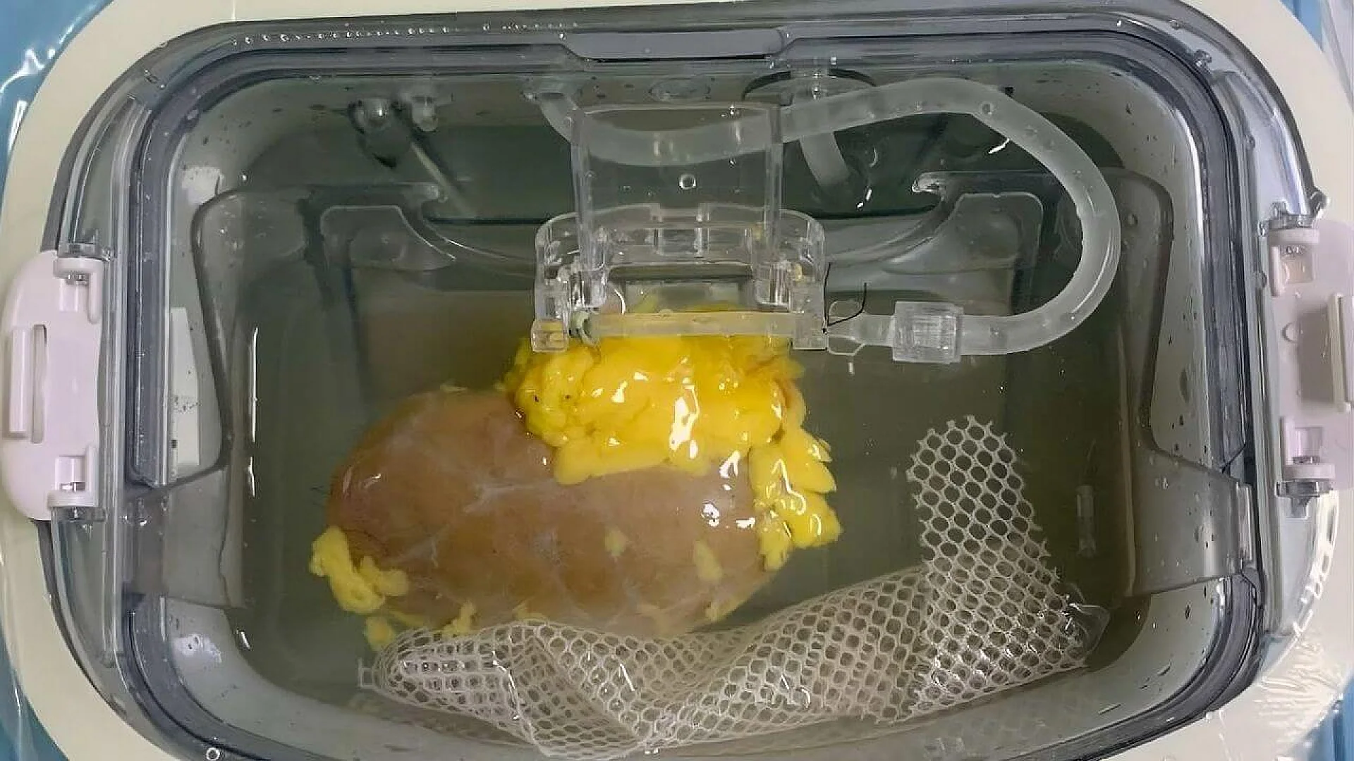 A human kidney in a perfusion device being treated with specialized enzymes to “strip” away blood-type antigens. This process circulates the solution through the organ’s blood vessels to create a universal kidney compatible with any recipient.