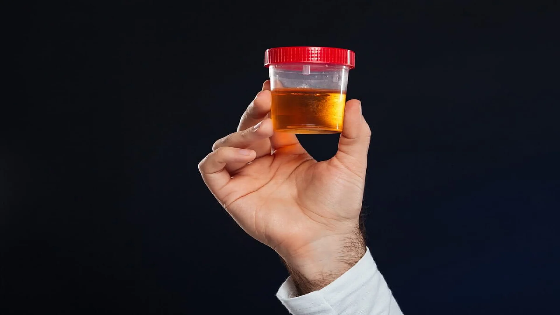 Close up of male's hand holding container with urine sample.