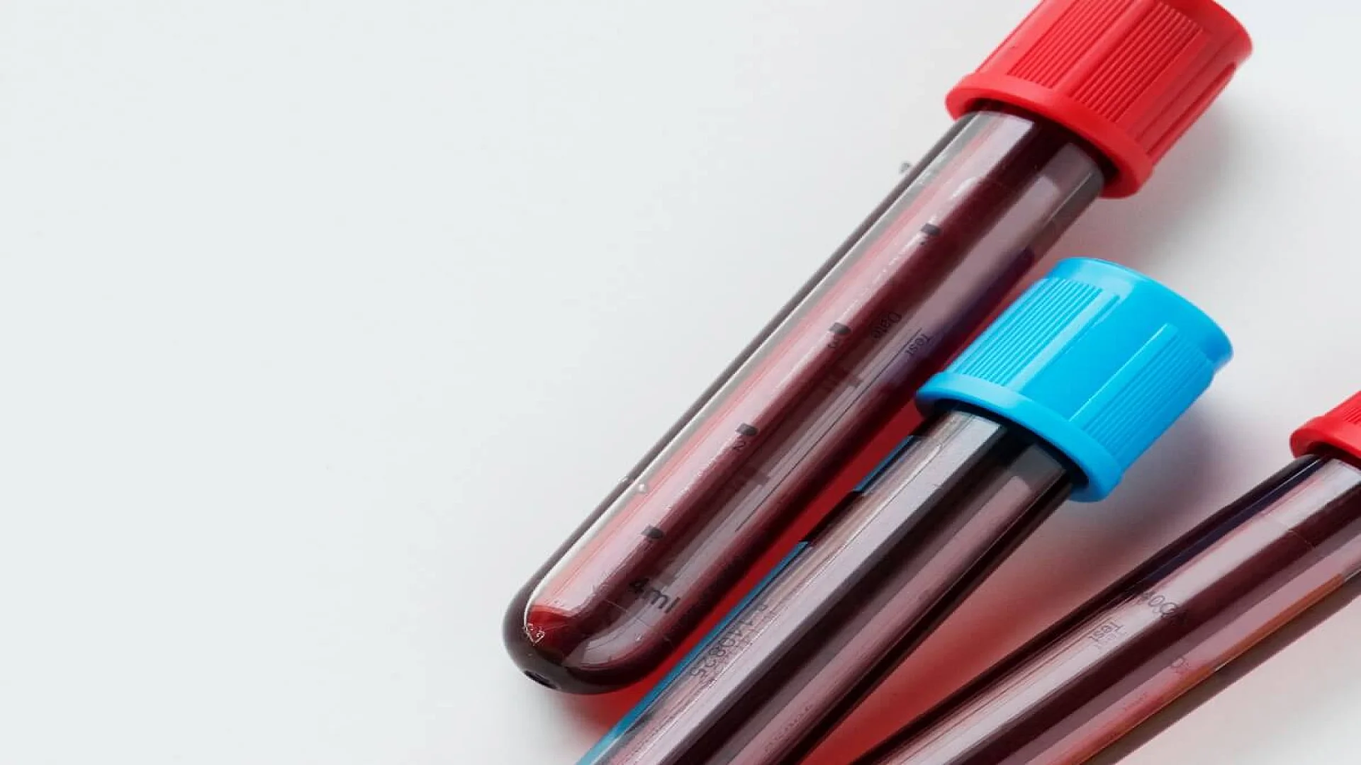 Steps for Blood Sample Preservation for PT/APTT