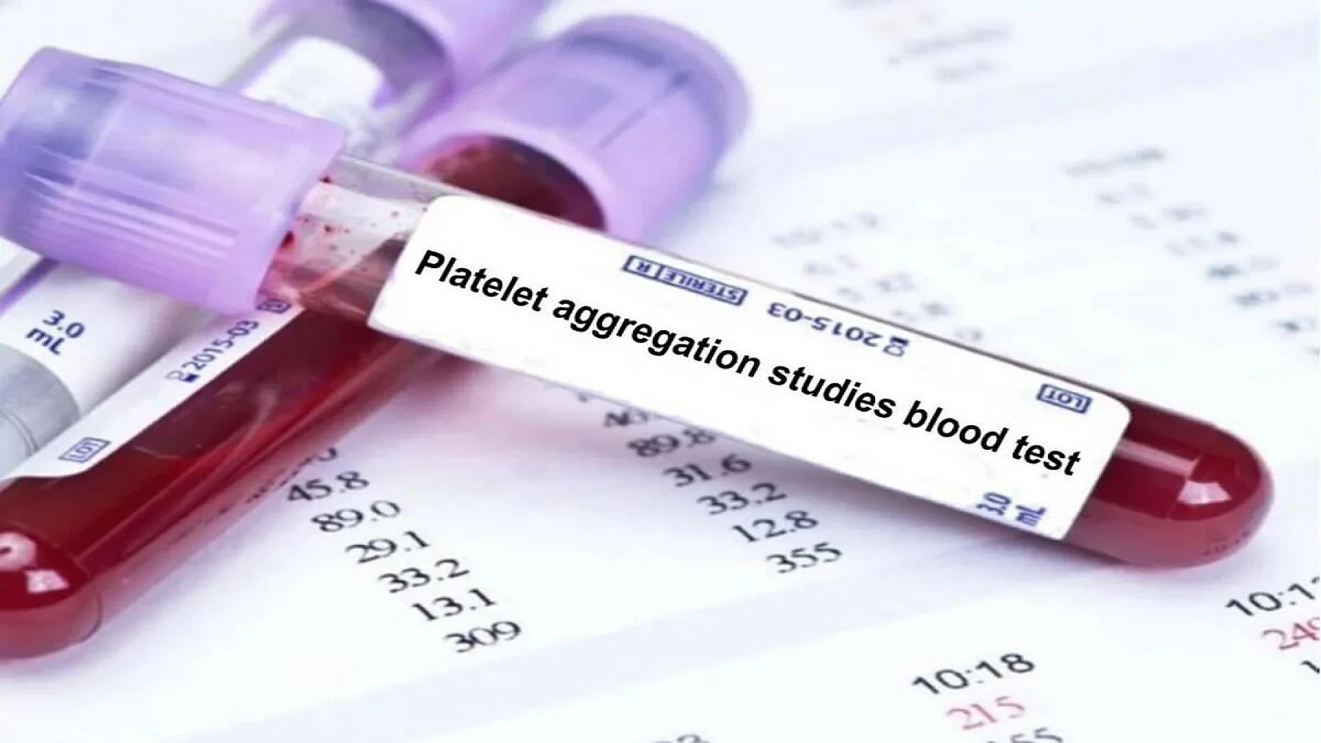 Platelet Function Test