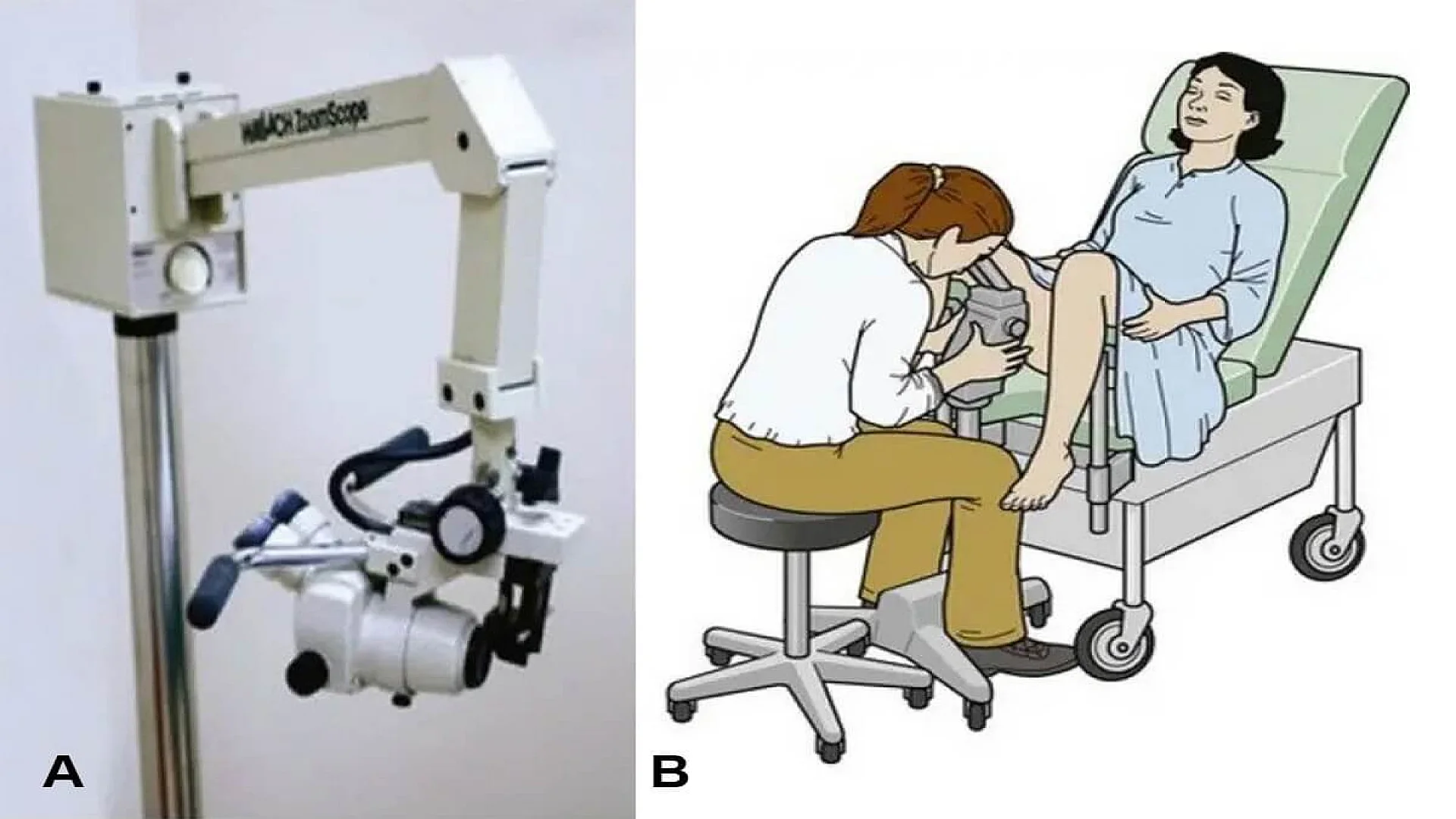 Colposcope (A) and method of examination (B). This technique is not a standard intervention by an emergency physician.