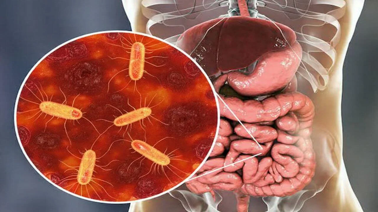 A illustration showing a close-up of flagellated bacteria in a circular inset overlaid on a diagram of the human digestive system and intestines.