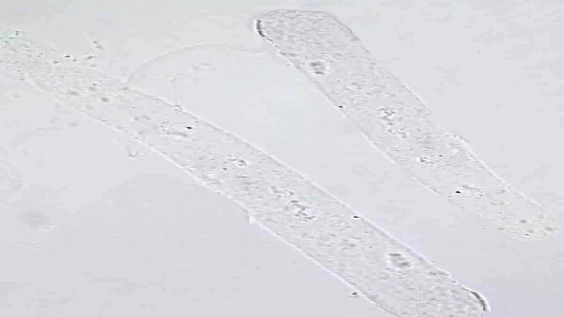 Hyaline Casts