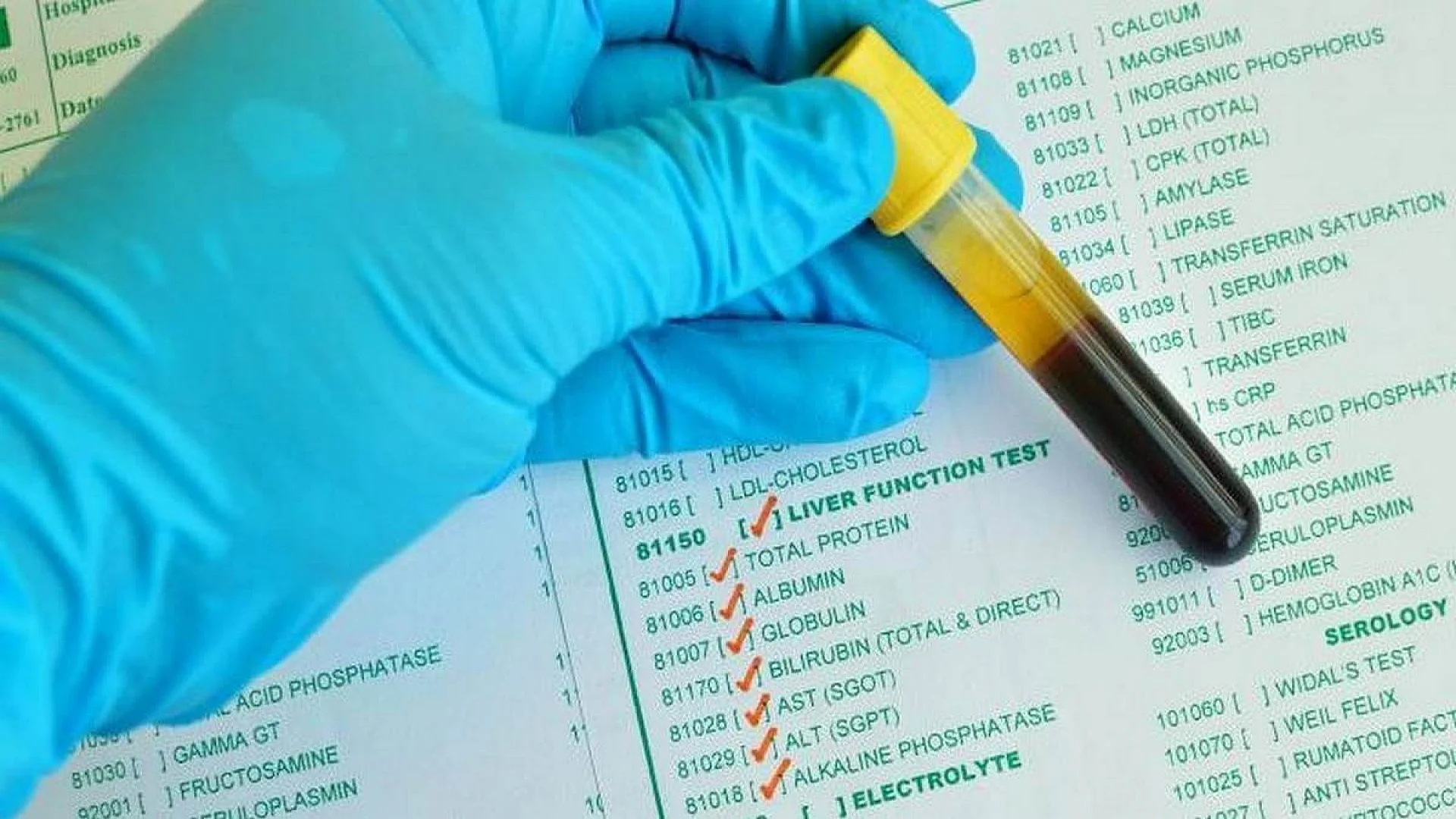Serum albumin test.