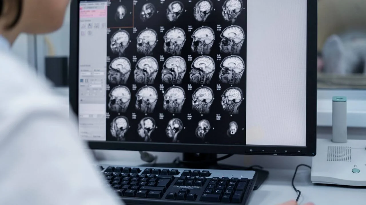 Brain ct scan x-ray film