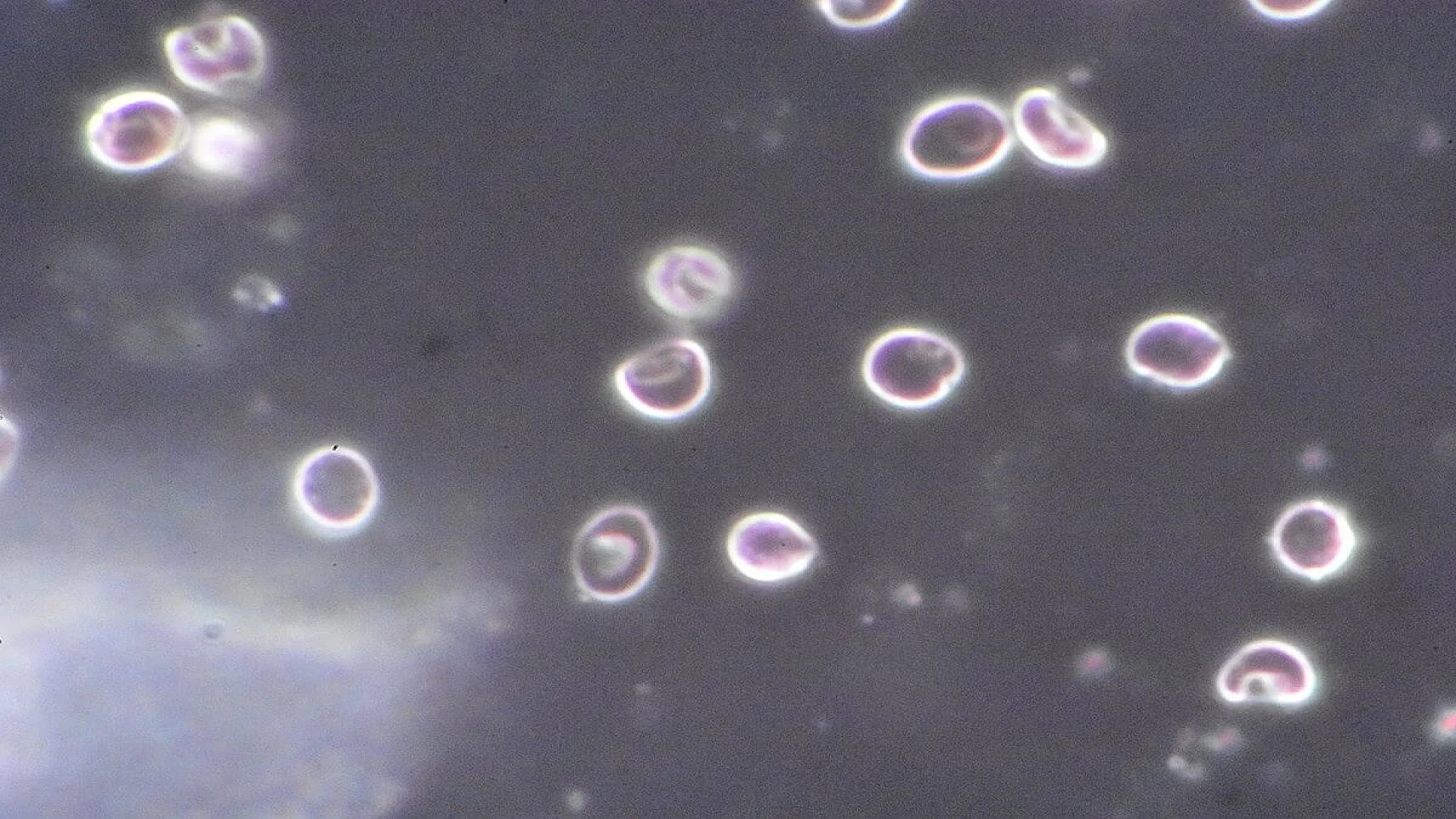 Red blood cells as seen by darkfield microscopy. This file is licensed under the Creative Commons Attribution-Share Alike 4.0 International license.