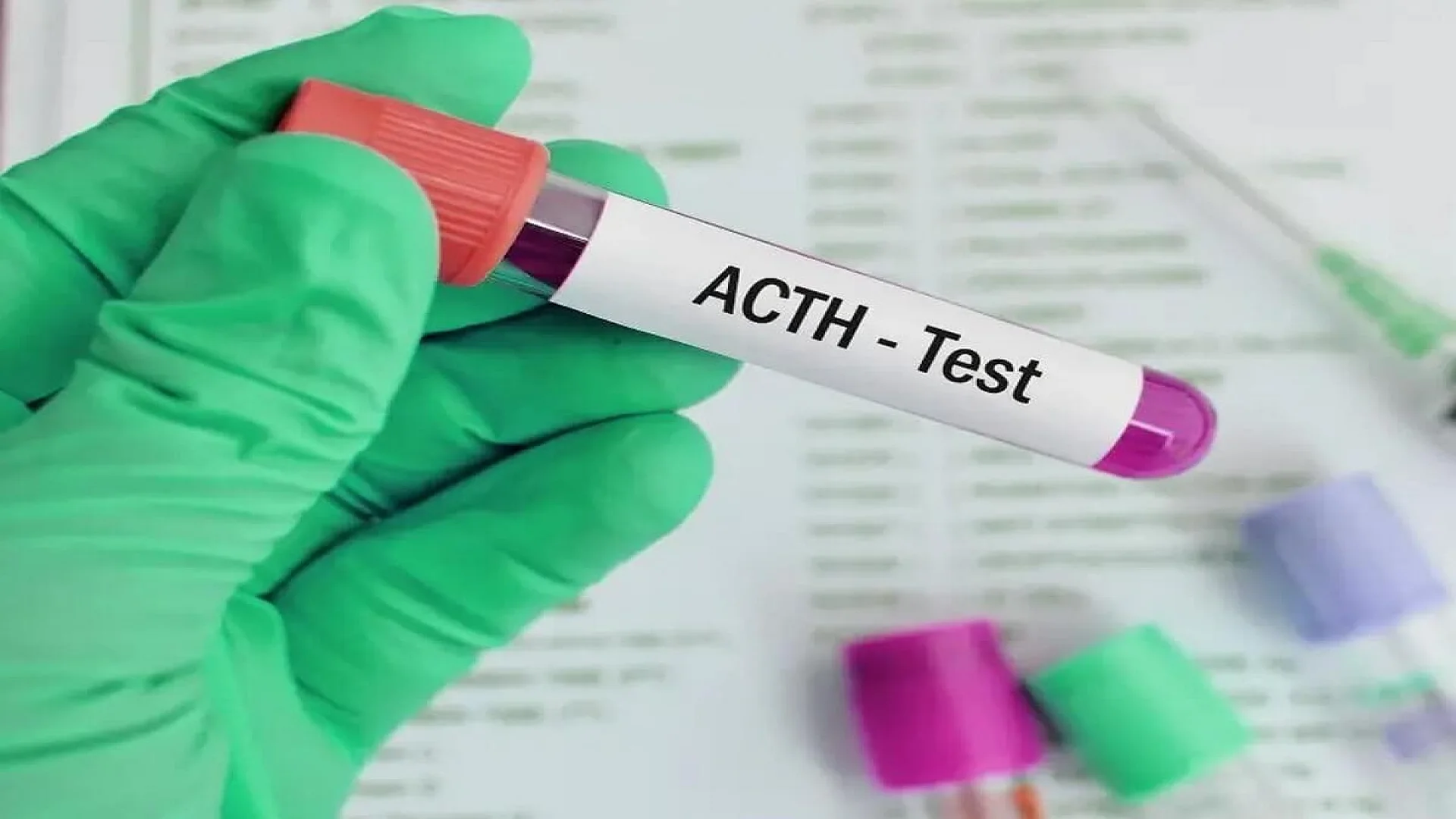 Adrenocorticotropic Hormone (ACTH) test.