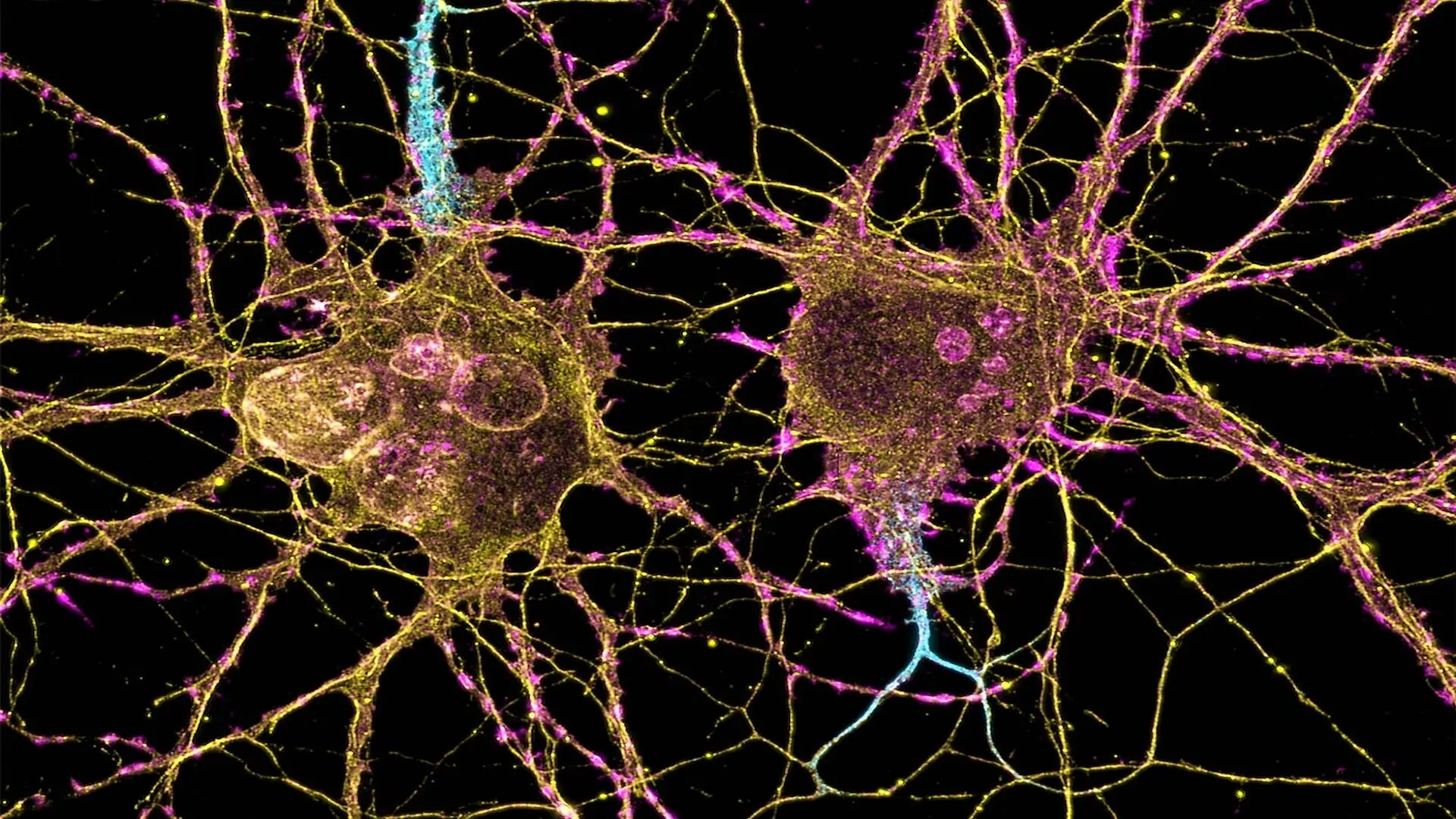 Neurons Under The Microscope