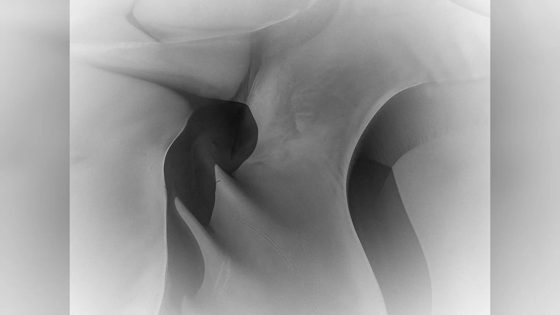 How Physical Force and Inflammation Drive Joint Destruction in Osteoarthritis