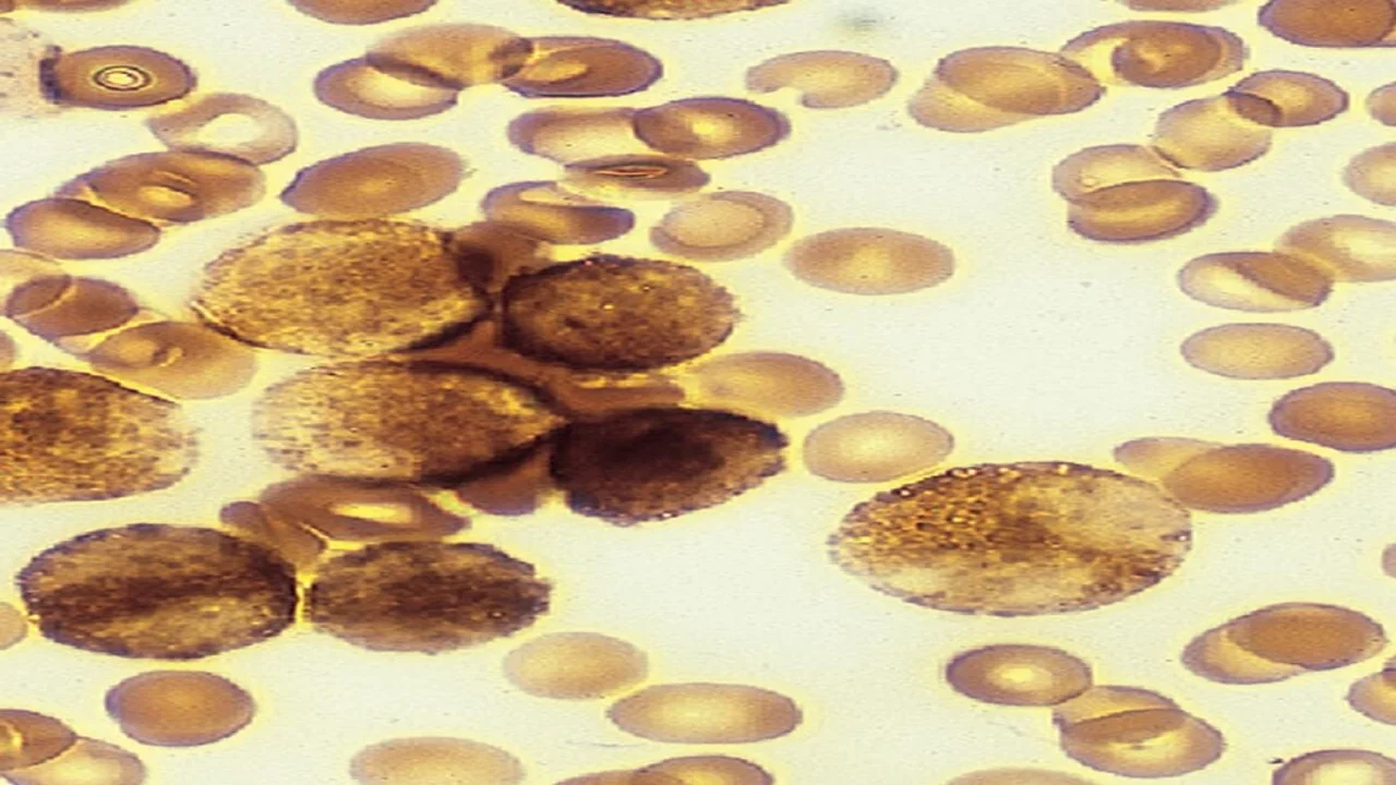 Myeloperoxidase Stain Demonstrating Neutrophils