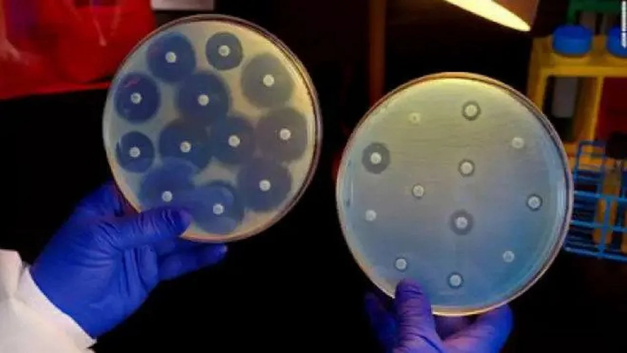 CDC sees 'steady increase' in drug-resistant bacteria.