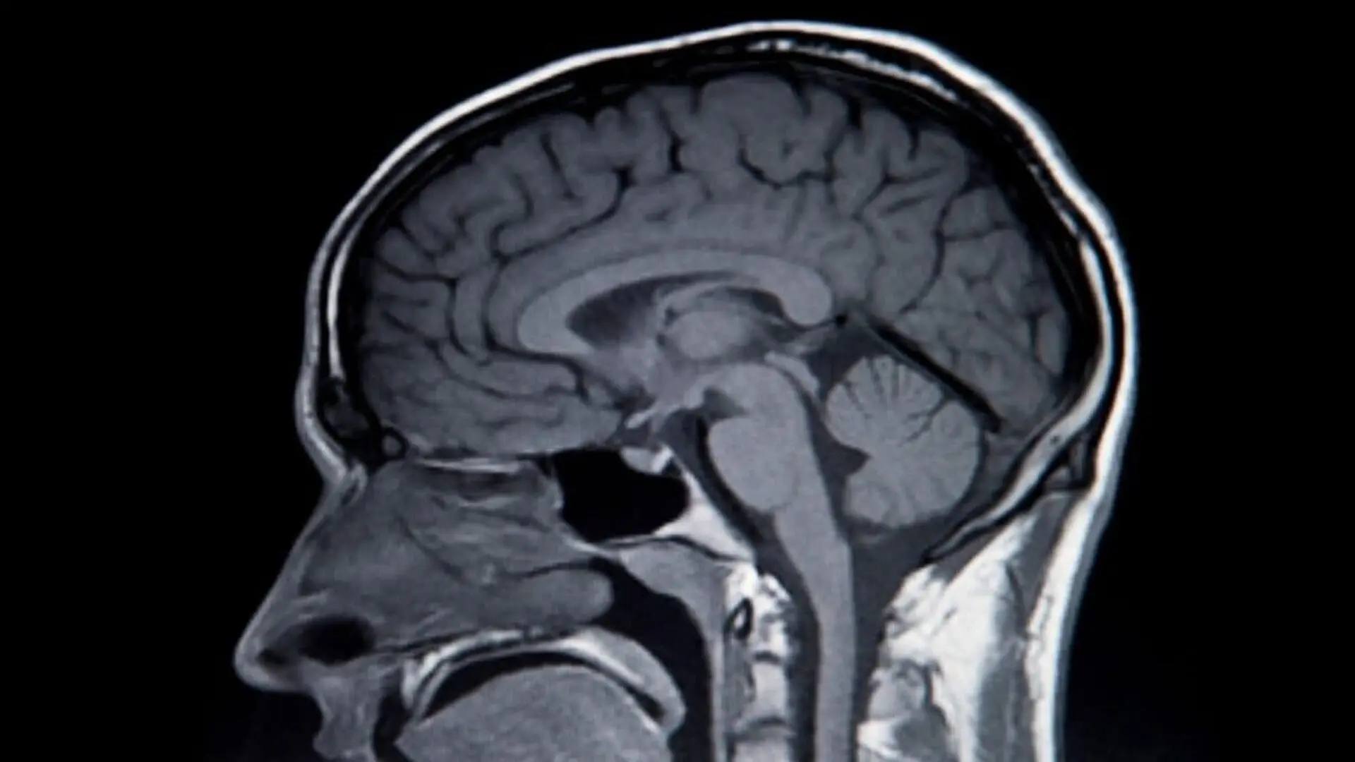 Scientists Discover A Way To Restore Memory By Fixing Disrupted Brain Signals Scaled