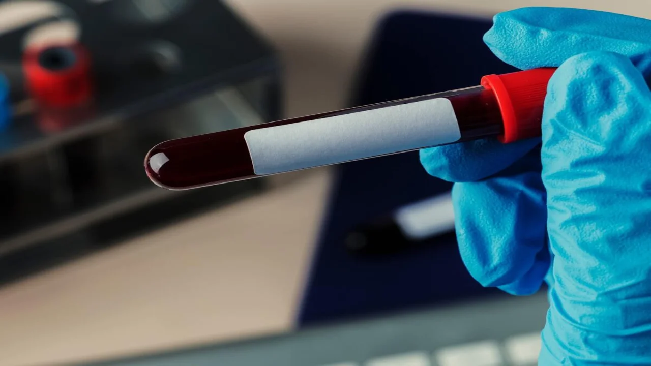 Surgeon holding a blood test tube.