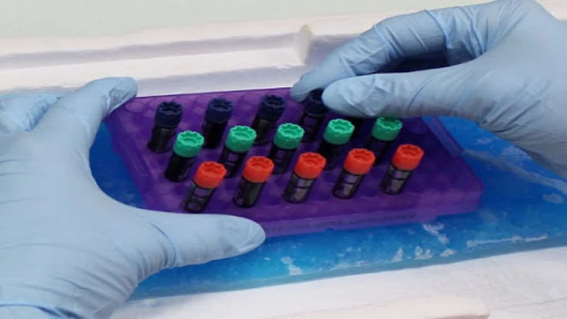 New finding: Biobank storage time affects blood test results.