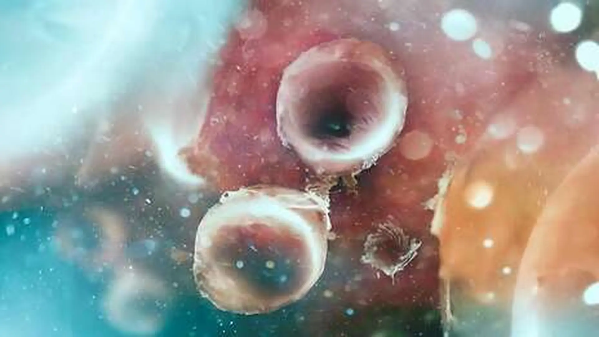 Cells Under An Electron Microscope Shallow Depth Of Field Scaled