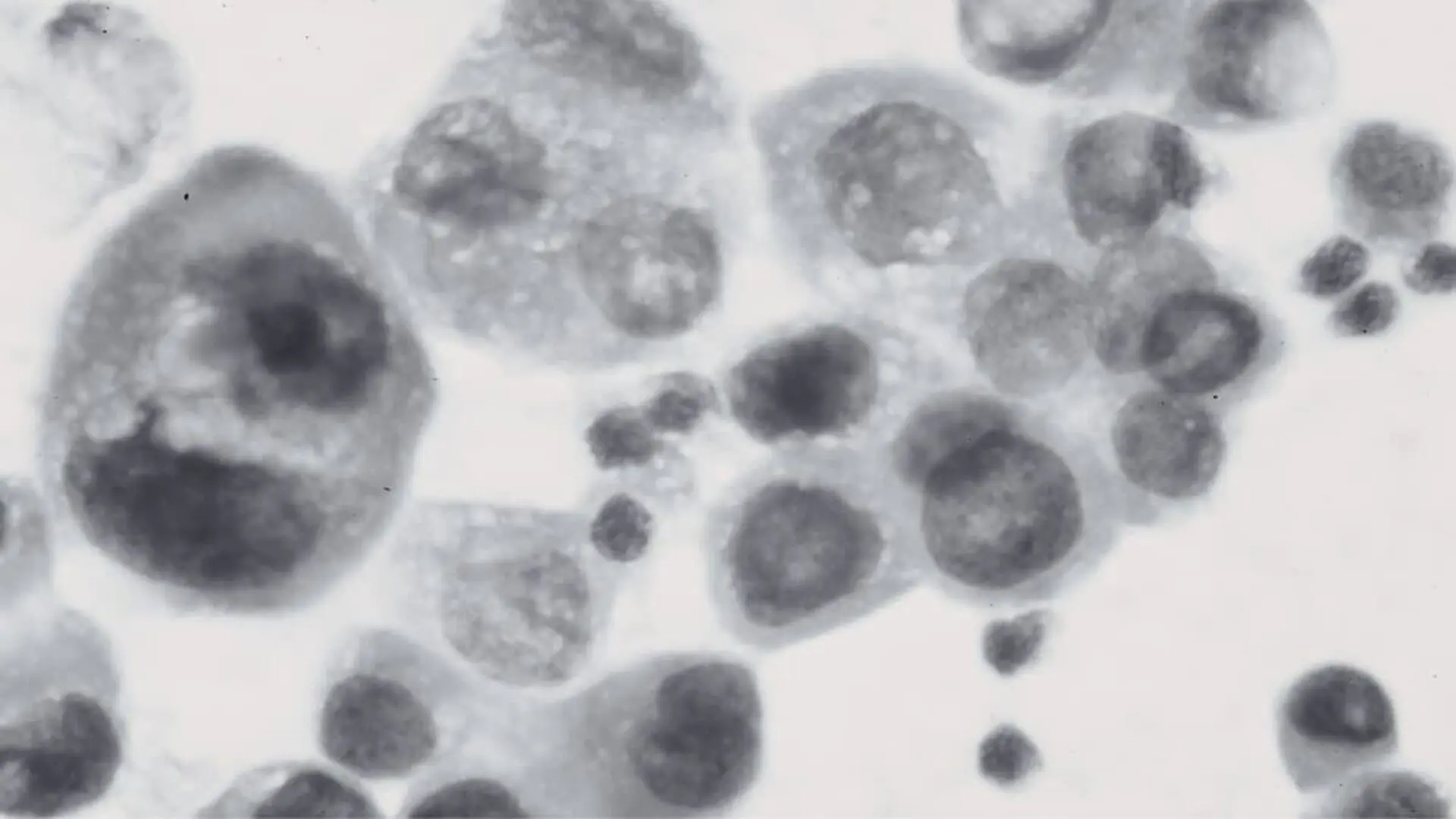 The Cell Discovery That Could Lead To More Precise Treatments For High Blood Pressure Scaled
