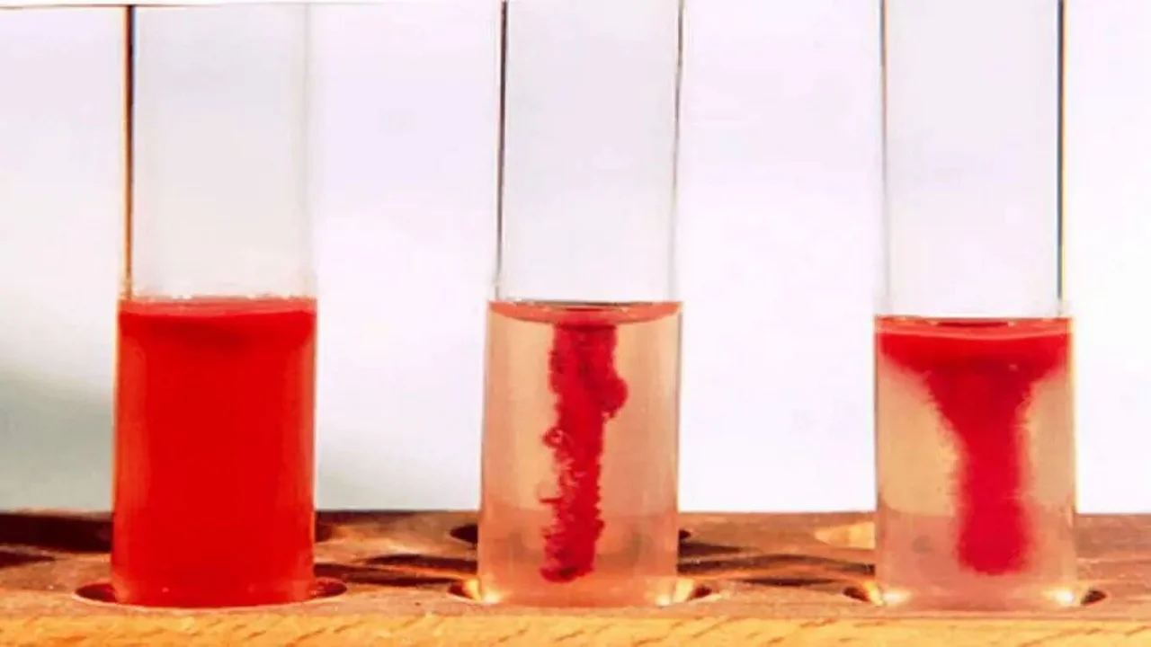 Test for Bacterial Motility: Center (Non-motile); Corners (Motile)