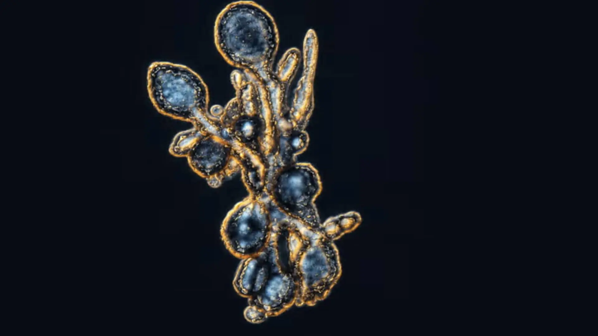 A shot of breast tissue cells on a dark background.