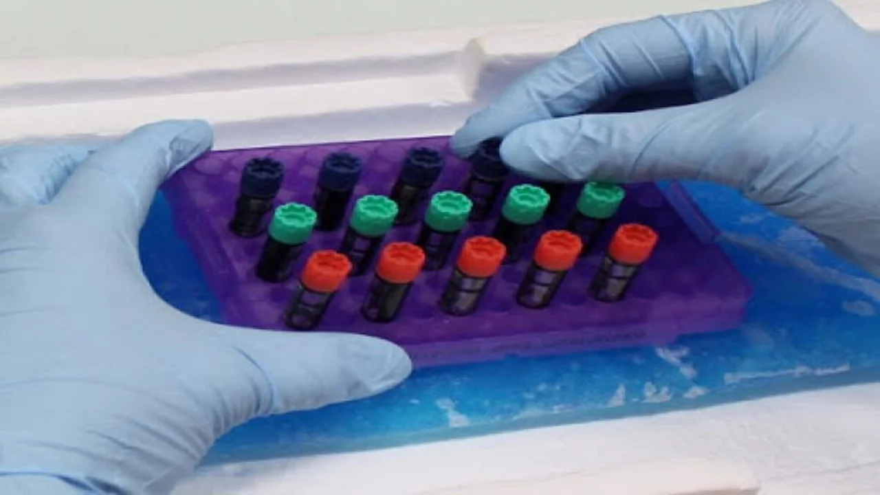 New finding: Biobank storage time affects blood test results.