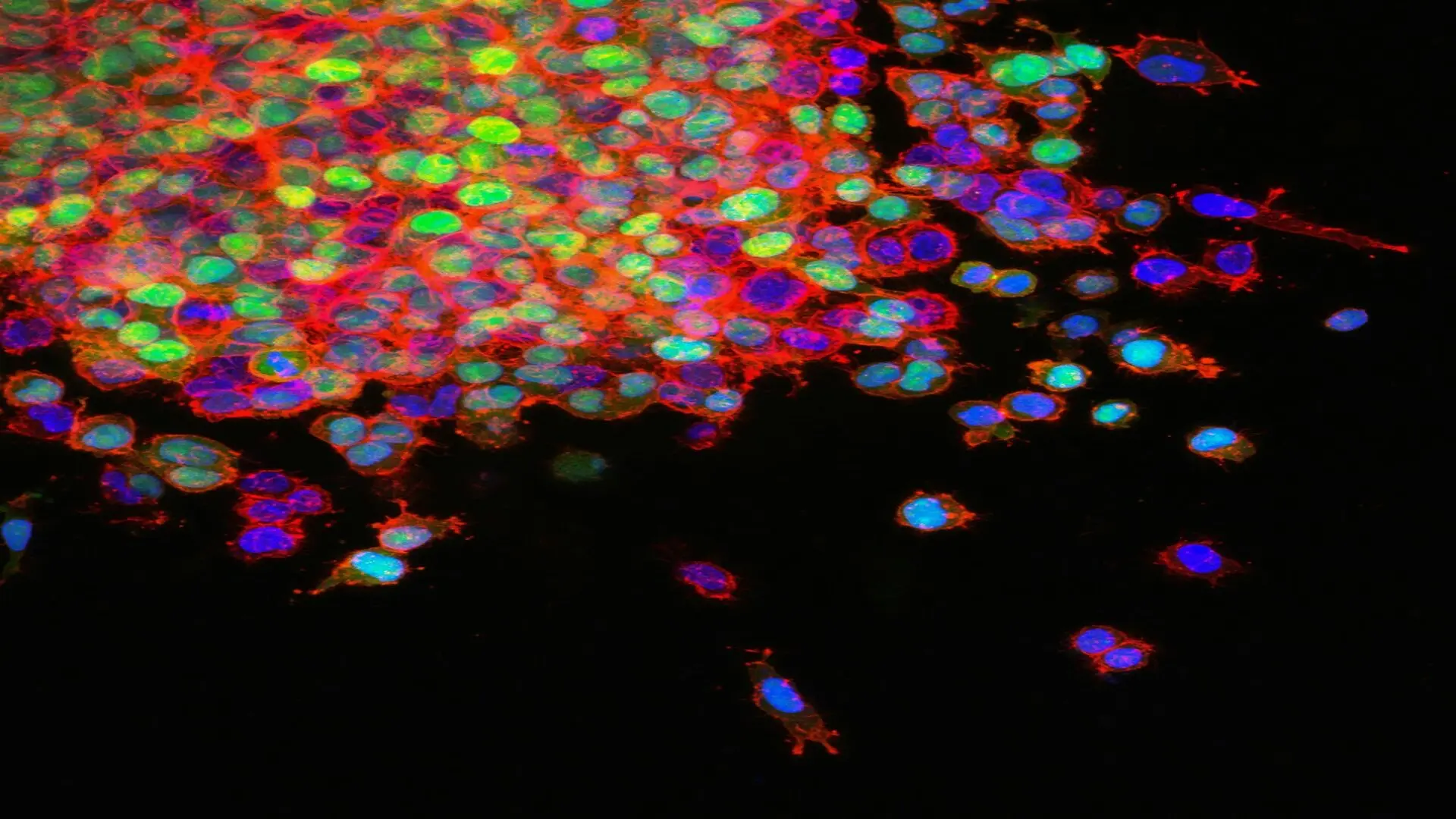 Mestastizing Lung Cancer Cells