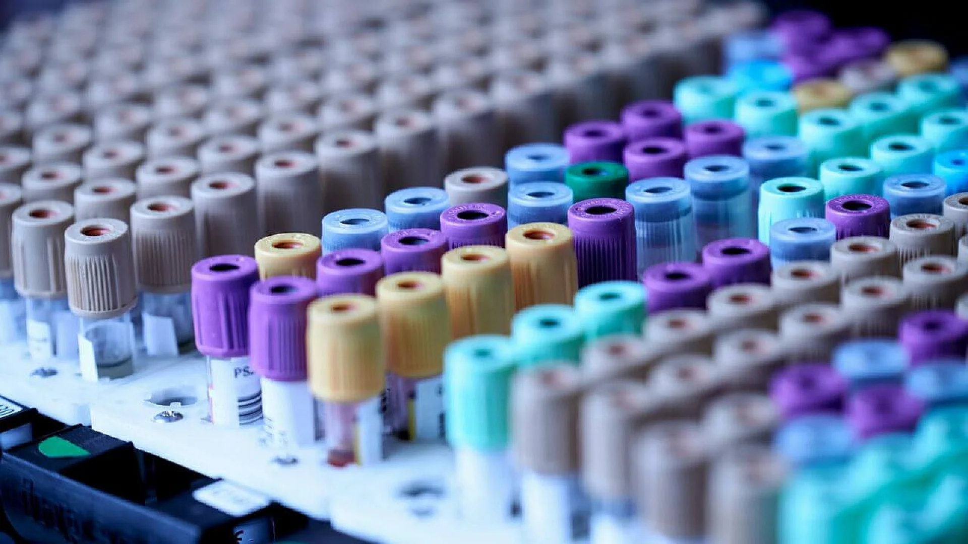Rows of medical specimen collection tubes with color-coded caps organized in a white laboratory rack.