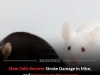 Stem Cell Transplant Repairs Brain Damage and Restores Movement After Stroke in Mice