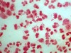 Scientists develop new antibiotic for gonorrhea
