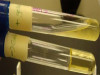 GELATINASE TEST (GELATIN LIQUEFACTION)