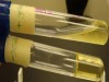 GELATINASE TEST (GELATIN LIQUEFACTION)