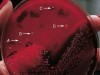 HEMOLYTIC REACTIONS
