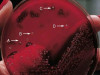 HEMOLYTIC REACTIONS