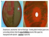 OPTOCHIN DISC TEST