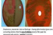 OPTOCHIN DISC TEST