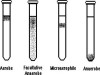 OXYGEN REQUIREMENT TEST (Thioglycollate Test)
