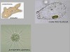 Pseudopodia in Protozoa