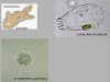Pseudopodia in Protozoa