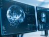 Arc Protein Hijacked to Spread Toxic Tau: New Pathway Offers Fresh Alzheimer’s Target