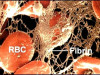 Blood Clotting Process