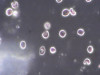 Dark Field Microscopy