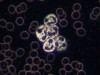 Understanding Darkfield Microscopy: Explore Advantages, Limitations, and the Fundamental Principle