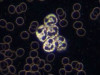 Understanding Darkfield Microscopy: Explore Advantages, Limitations, and the Fundamental Principle