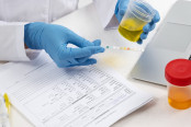 Test for Detection of Urobilinogen in Urine
