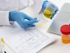 Test for Detection of Urobilinogen in Urine