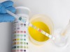Tests for Detection of Glucose in Urine
