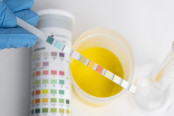 Tests for Detection of Glucose in Urine