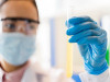 Chemical Examination of Urine